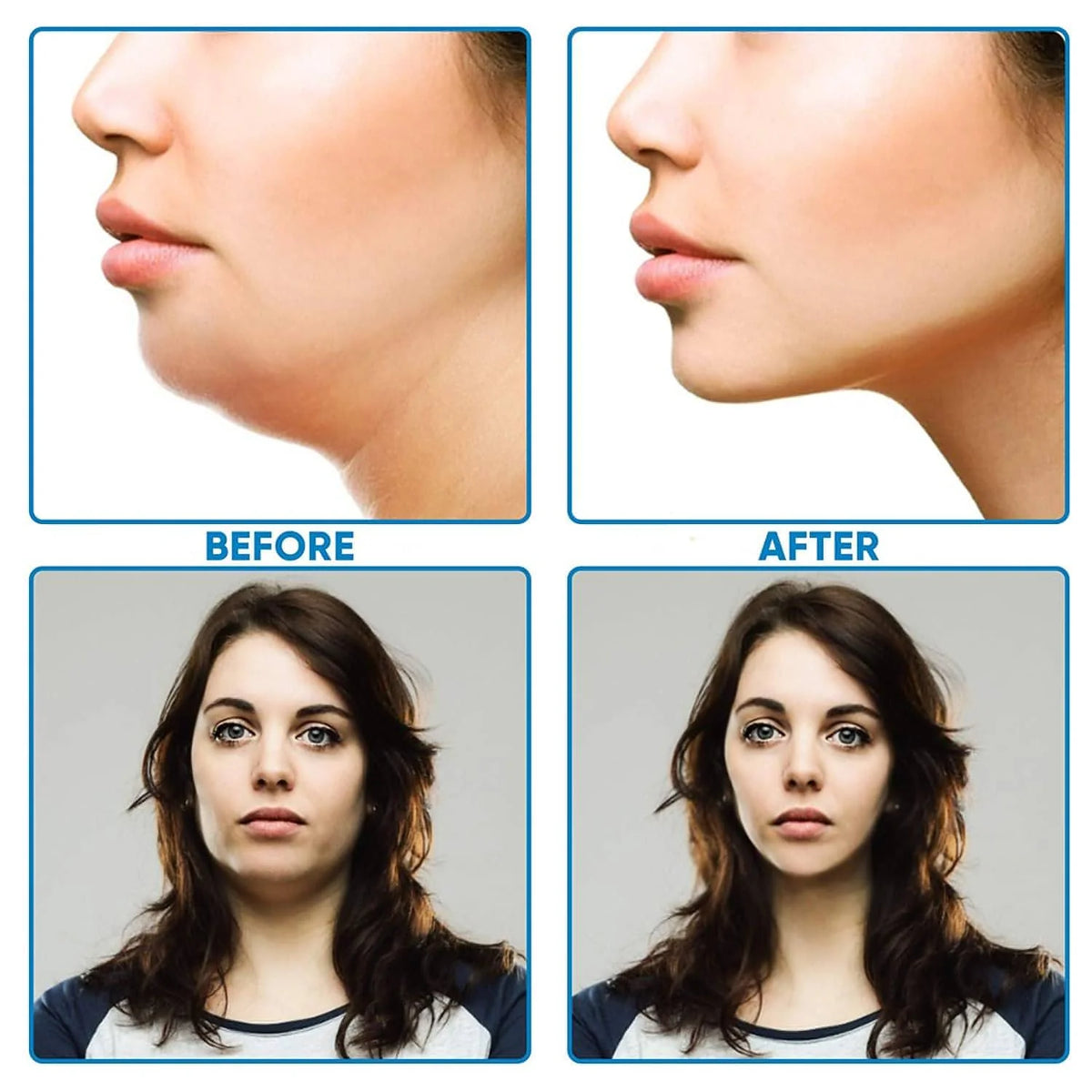 V-Line Face Slimming Belt | Adjustable Double Chin Reducer & Facial Lifting Strap